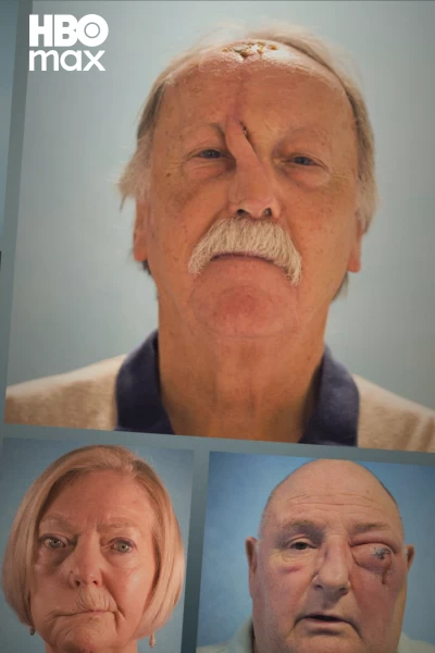 Cirugía facial