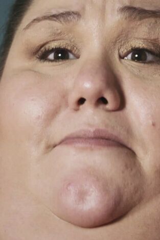 Mi vida con 300 kilos. T(T6). Mi vida con 300... (T6): La historia de Alicia
