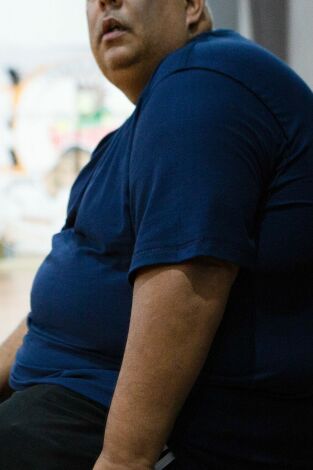 Mi vida con 300 kilos: Brasil. T(T1). Mi vida con 300... (T1): Welton y Marcelo
