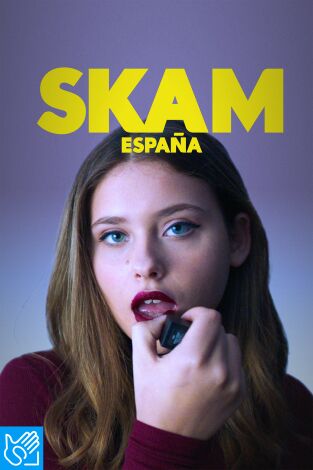 (LSE) - Skam