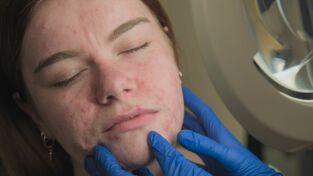 Dra Emma: Clínica dermatológica. T(T4). Dra Emma: Clínica... (T4): Soy más que mi piel