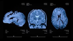 Aliens. Aliens: Los Experimentadores, Parte 2