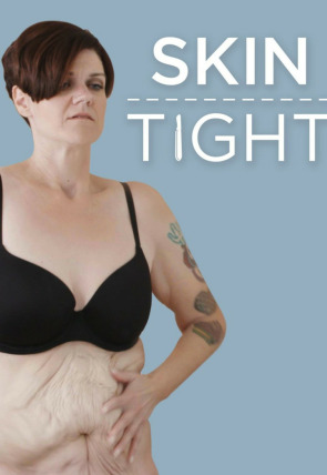 Póster de Mi vida con 300 kilos: Cirugía final