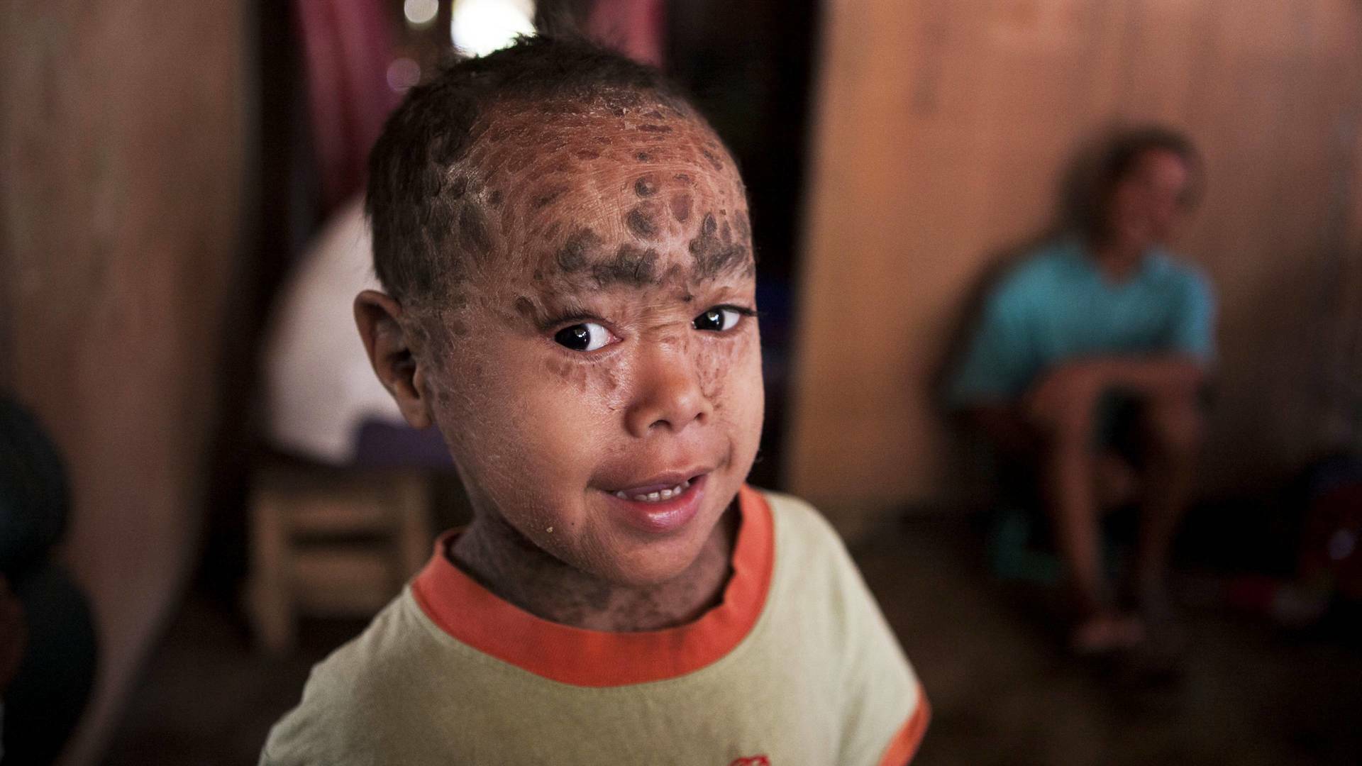 Diagnósticos... (T8): Vivir con medio cráneo