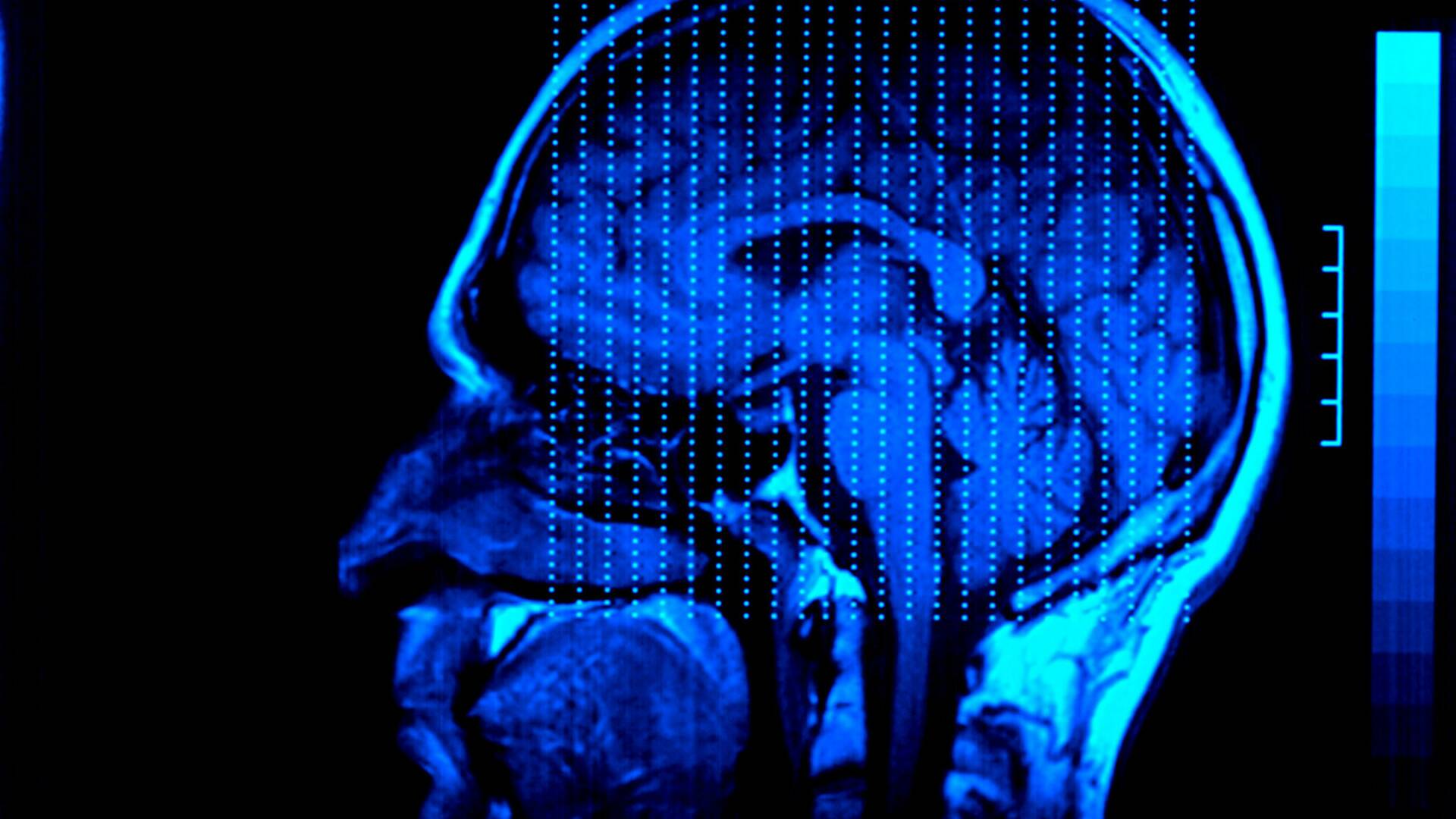 El cerebro de Caín: Ep.1