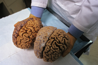 Imagen de Pon a prueba tu cerebro  - 3