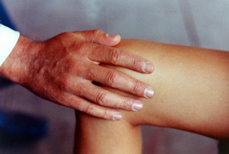 Imagen de La rodilla de Clara - 3