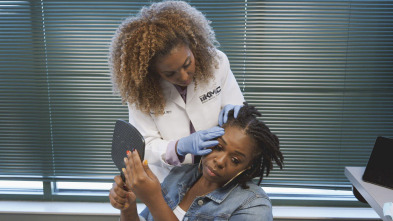 Bad Hair Day: Adiós, alopecia