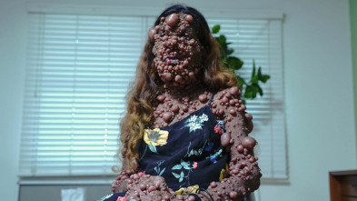 Imagen de Tumores extremos: Cubierto por miles de tumores - 2