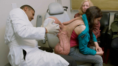 Tumores extremos: Un tumor de la mitad de su altura