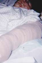 Imagen de Viviendo con un asesino: Silbaba mientras lo hacía - 1