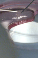 Imagen de Congelar la fertilidad - 2