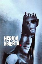 Imagen de Herida abierta - 2
