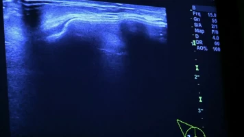 Desastres estéticos