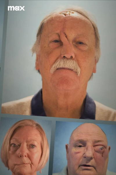 Cirugía facial